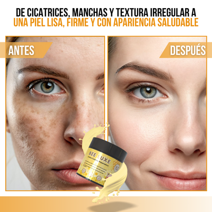 BeeLuxe™ - Restaura, reafirma y renueva tu piel con el poder natural del veneno de abeja