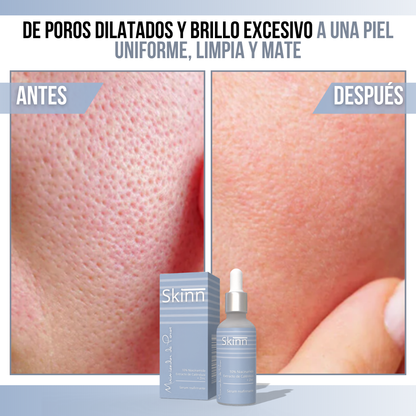 Skinn™ - Refina tu piel, revela tu brillo