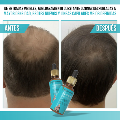 GrowthMax™ - Más crecimiento, menos caída, mejor cabello