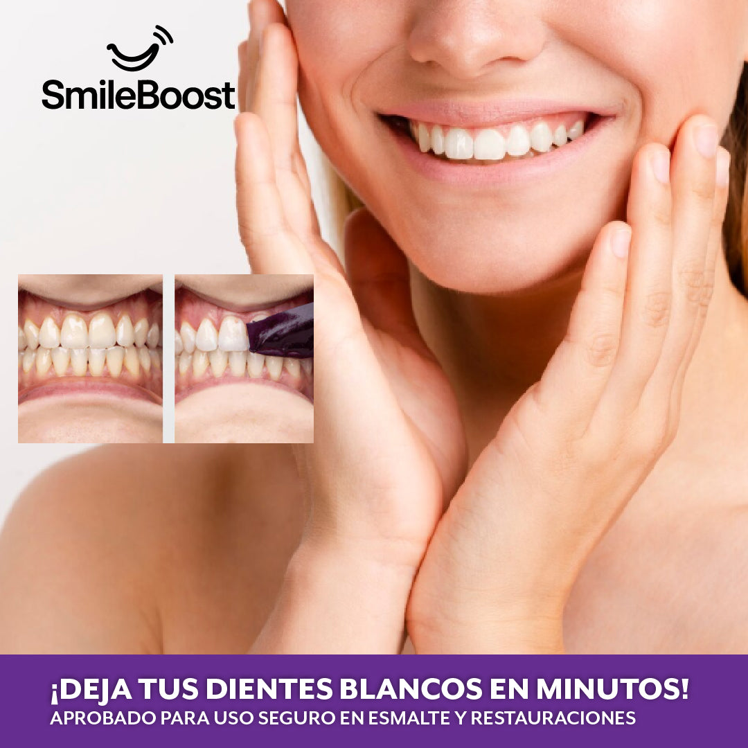 SmileBoost™ – Sonrisa brillante al en minutos