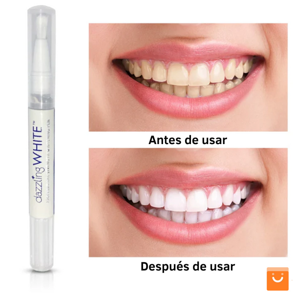 MySmile™ - Bolígrafo blanqueador de dientes (OFERTA  EXCLUSIVA  2 X 1)